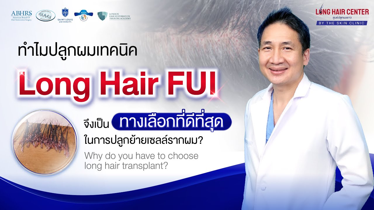 Cấy tóc nữ Long Hair FUI tại bệnh viện cấy tóc Dr. Top Hair Hospital