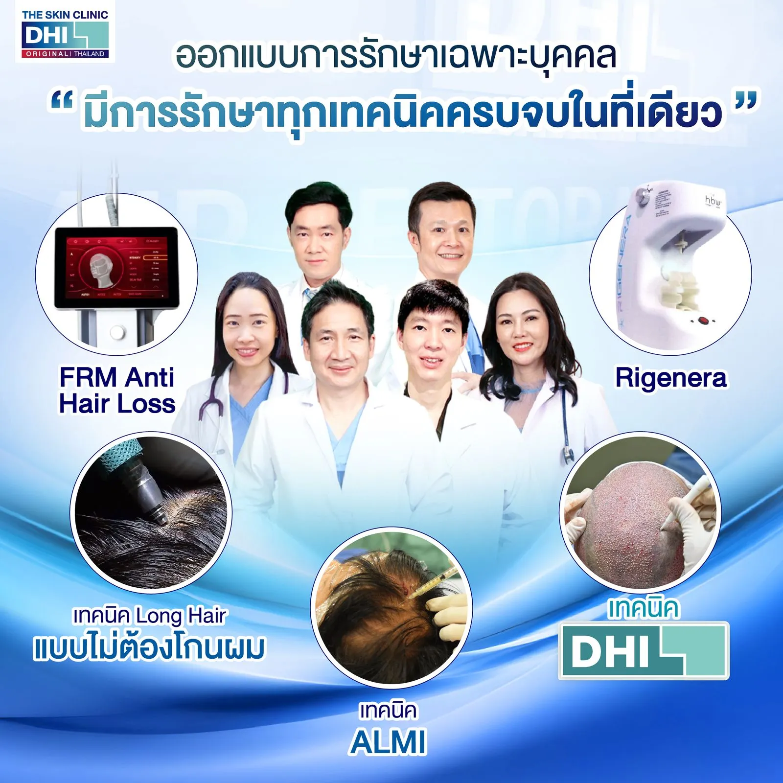 Cấy tóc DHI (DHI Hair Transplant) – kỹ thuật cấy tóc tại bệnh viện bằng Implanter.