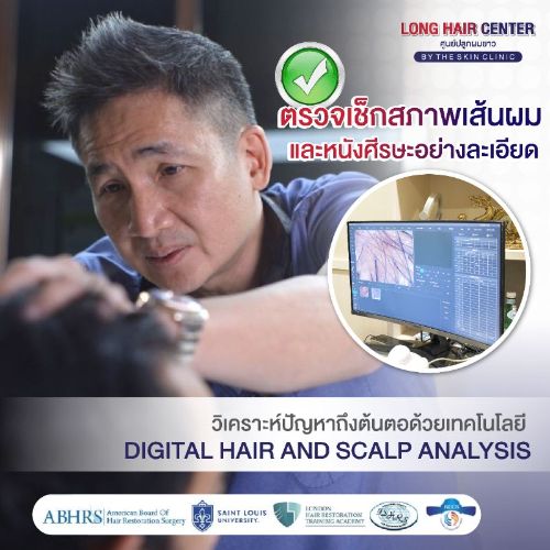 Cấy tóc DHI (DHI Hair Transplant) – kỹ thuật cấy tóc tại bệnh viện bằng Implanter.