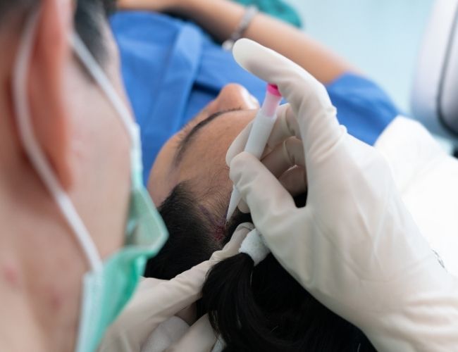 Tại sao phải chọn cấy tóc tại The Skin Clinic?