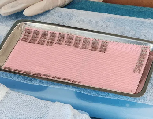 Quy trình cấy tóc kỹ thuật DHI Hair Transplant