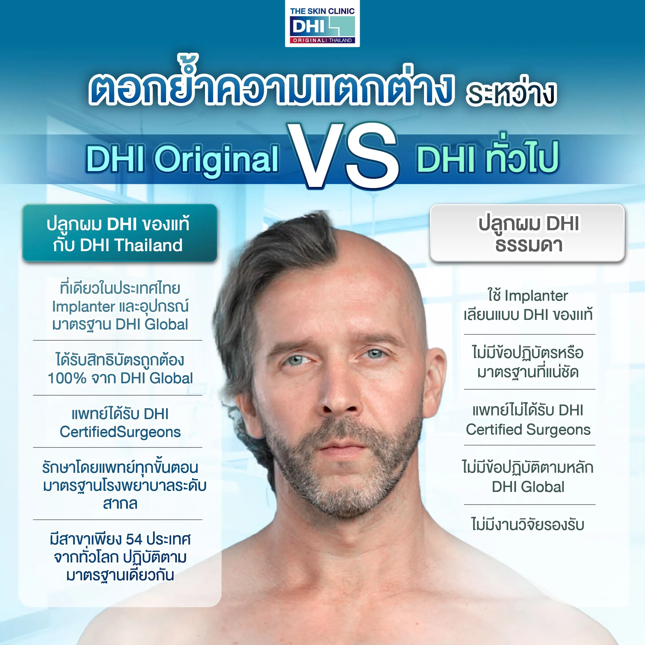 Cấy tóc DHI (DHI Hair Transplant) – kỹ thuật cấy tóc tại bệnh viện bằng Implanter.