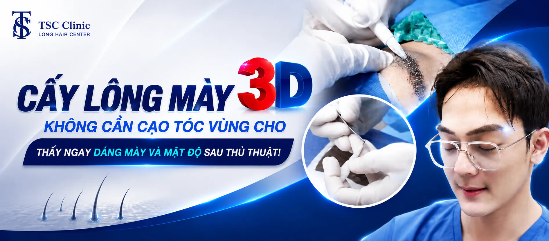Cấy lông mày Long Hair FUI 3D tại Dr.Top Hair Hospital Thái Lan