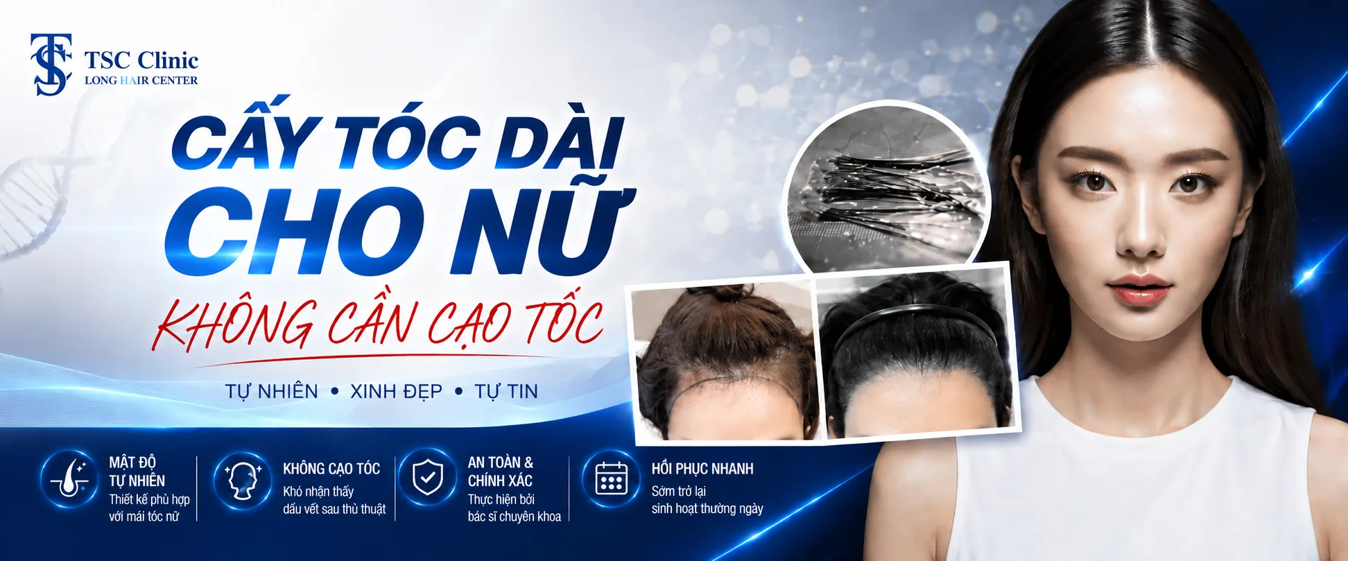 Cấy tóc nữ Long Hair FUI tại bệnh viện cấy tóc Dr. Top Hair Hospital