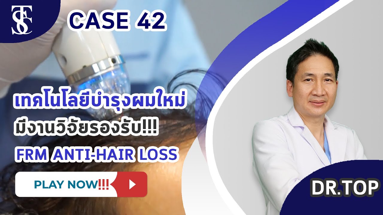 FRM Anti-Hair Loss – An innovation for thicker hair, say goodbye to thinning hair without transplantation.