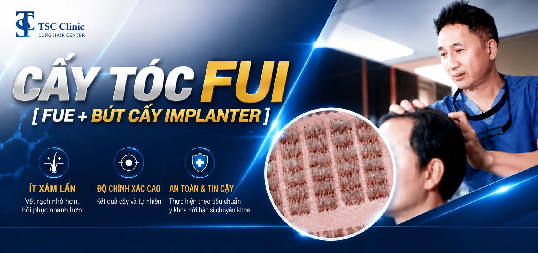 Kỹ thuật cấy tóc FUE không sẹo khâu, không phẫu thuật, không cần cạo tóc tại The Skin Clinic.