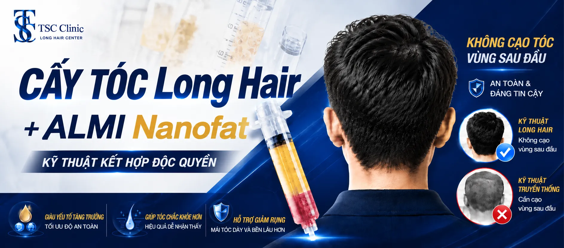 Cấy tóc FUI không cạo, không khuyết tại Dr.Top Hair Hospital Thailand