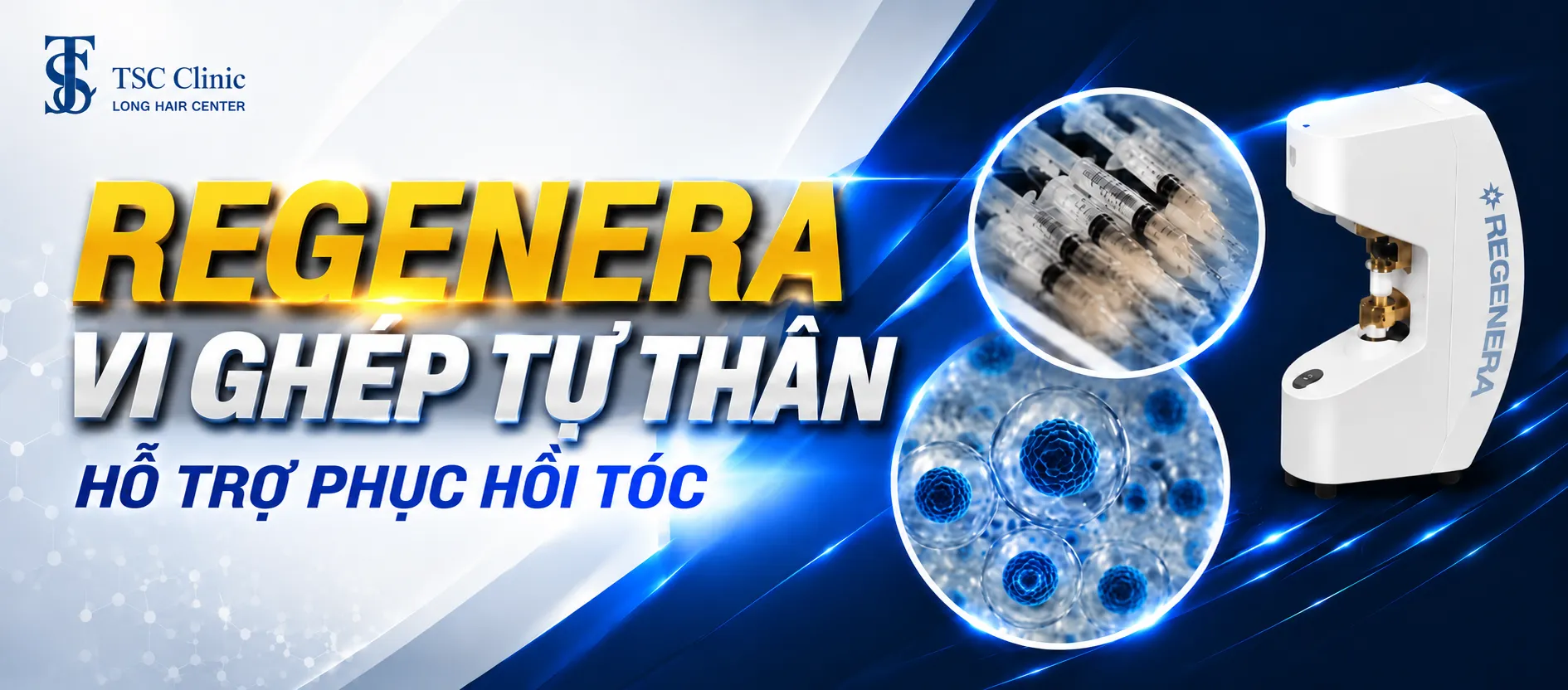 Regenera Micrograft Hair – cấy tóc Micrograft với công nghệ hiện đại, không cần cấy ghép nang tóc.