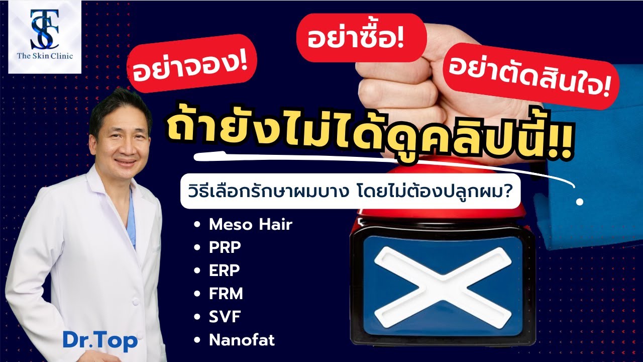 ALMI Nano Fat & SVF – Tăng mật độ tóc bằng tế bào mỡ