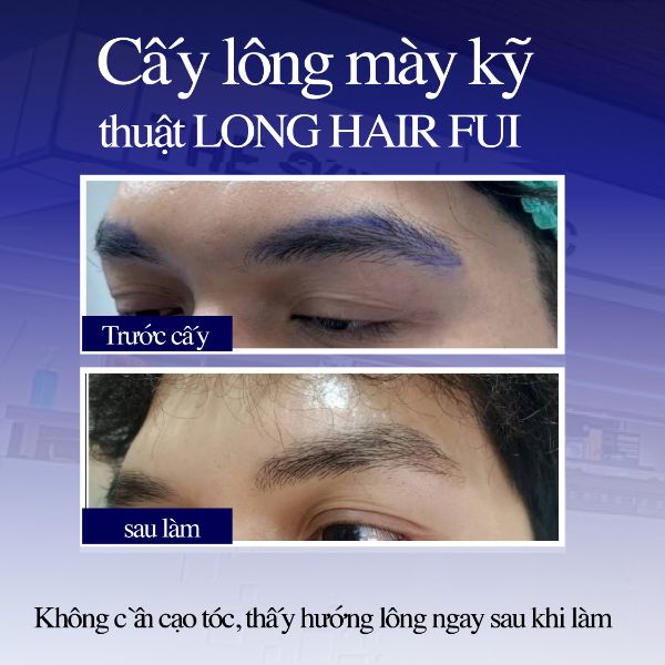 Đánh giá dịch vụ cấy lông mày 3D Long Hair FUI tại Dr.Top Hair Hospital