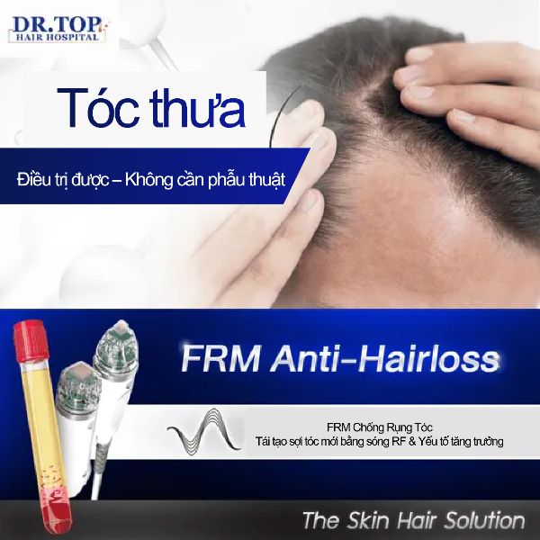 FRM Anti Hair Loss kích thích nang tóc bằng sóng RF