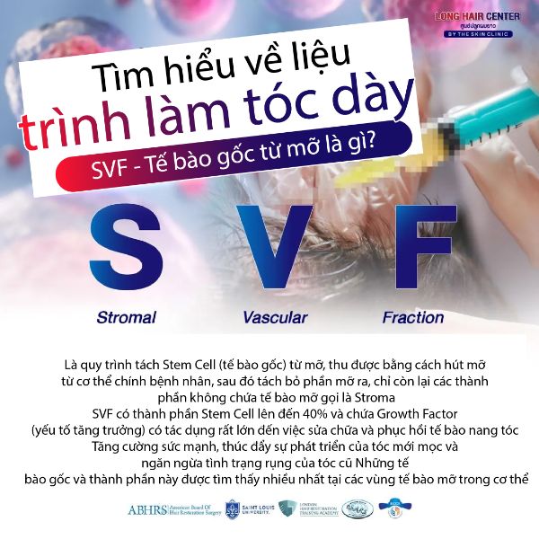 ALMI Nano Fat & SVF – Tăng mật độ tóc bằng tế bào mỡ