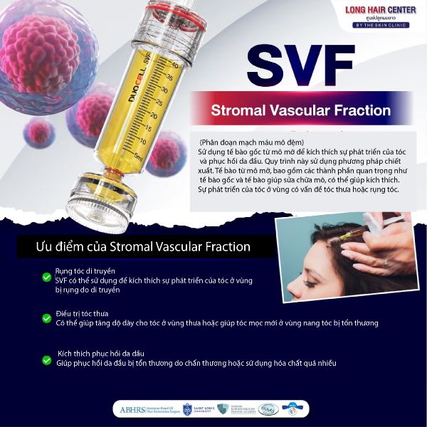 Điều trị rụng tóc, tóc thưa, hói đầu tại Dr.Top Hair Hospital